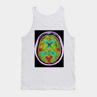 Normal brain blood flow, MRI and SPECT (C026/8000) Tank Top